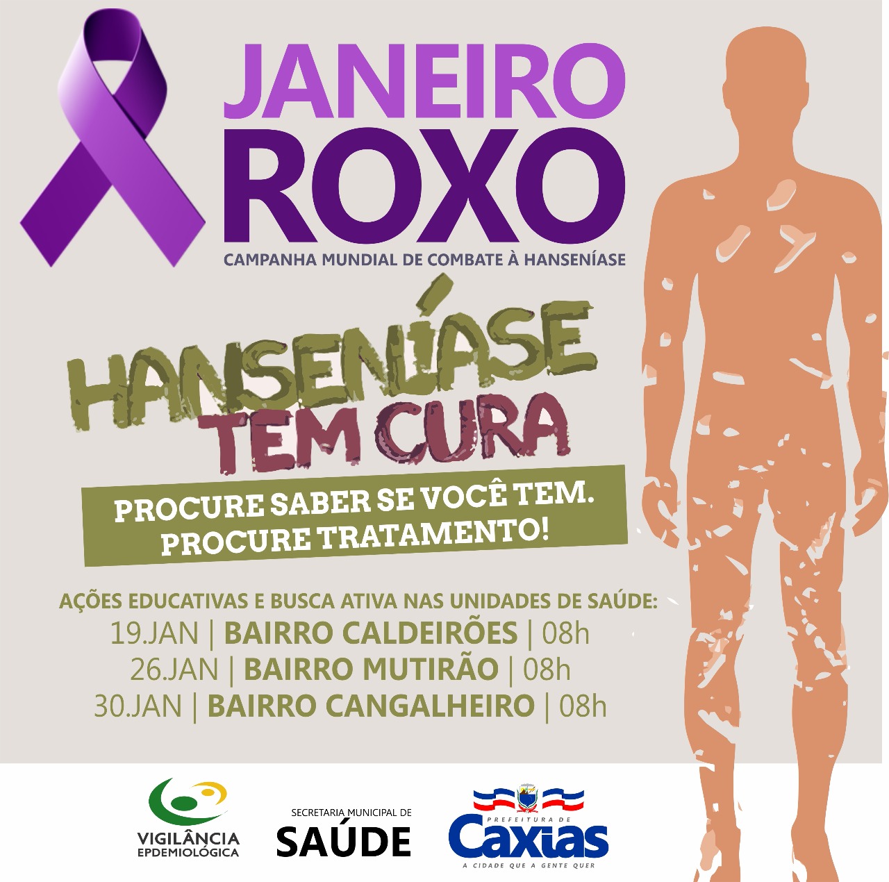 Janeiro Roxo” alerta para o diagnóstico e tratamento da hanseníase