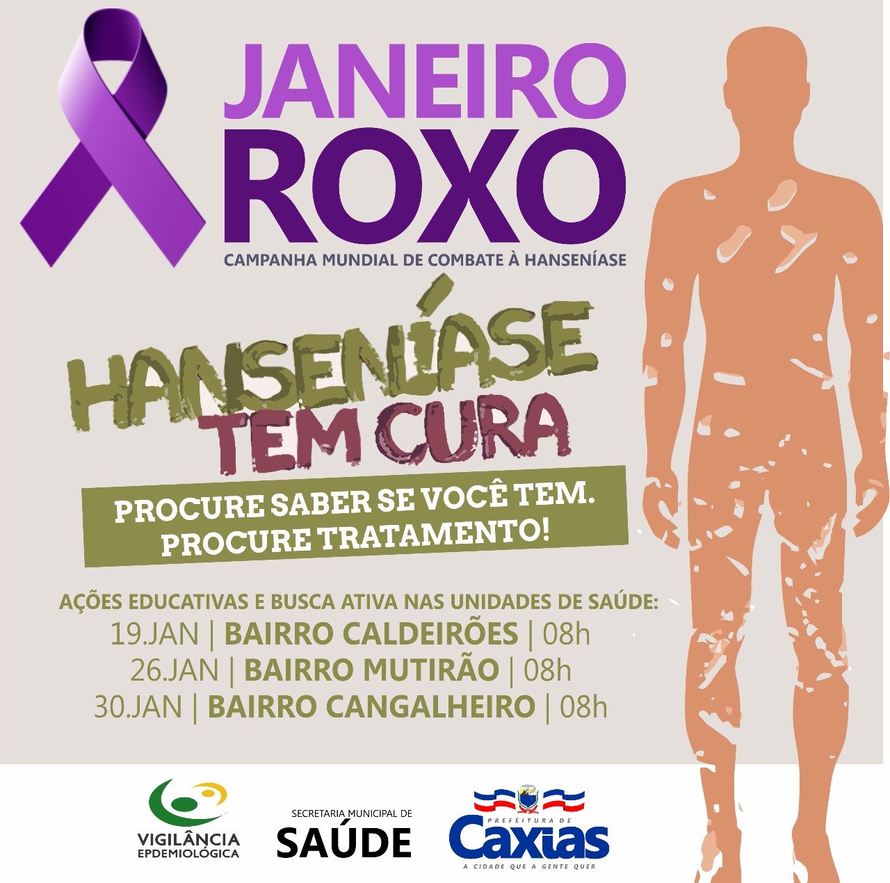 Notícia - Ações do Janeiro Roxo conscientizam sobre a hanseníase